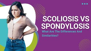 Scoliosis vs Spondylosis What Are The Differences And Similarities [upl. by Normandy]