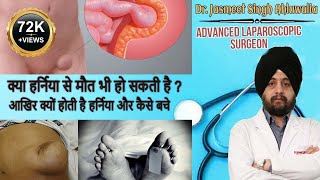 Symptoms of hernia  Hernia ke lakshan  हर्निया के लक्षण  Hernia symptoms in Hindi [upl. by Alyaj]