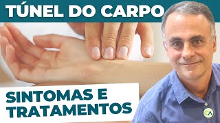 Síndrome do Túnel do Carpo  Sintomas e Tratamento [upl. by Hutner]