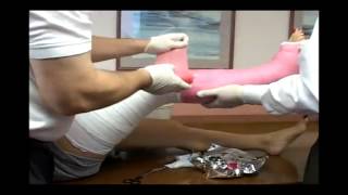 Application Long Leg Cast  Fiberglass Medical Leg Cast [upl. by Aidnic]