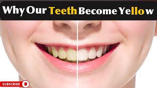 Why does our teeth turn to Yellow Yellow Teeth  Teeth yellowness and discoloration  MHCP [upl. by Dash]