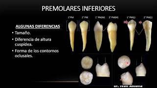 ANATOMÍA DENTARIA Unidad 25 Premolares inferiores Segundo premolar inferior parte 2 [upl. by Airtened987]