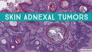 Skin Adnexal Tumors Dermatopathology Unknown Cases [upl. by Milicent]