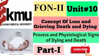 How to recognize a dying patient  5 signs of approaching death [upl. by Eiddam]