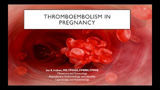 Thromboembolism in Pregnancy [upl. by Ytsur]