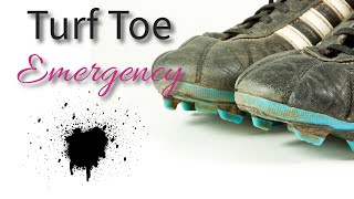 Turf Toe Emergency [upl. by Zehcnas]