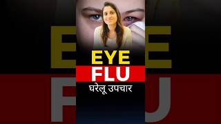 आई फ्लू से बचाव  Eye flu Prevention [upl. by Thomasine]