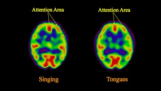 Neuroscience of Glossolalia [upl. by Auqinaj306]