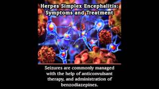 Herpes Simplex Encephalitis Symptoms and Treatment [upl. by Emma744]