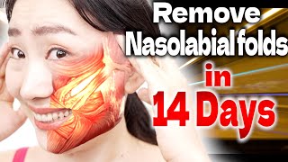 Do this Massage for 14 Days to Remove Nasolabial Folds [upl. by Irmine693]