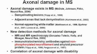 Multiple Sclerosis Inside Out model part 1wmv [upl. by Aillij]