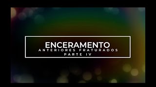 PARTE 4 ENCERAMENTO ANTERIOR [upl. by Elyrrad709]