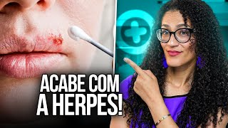 Herpes Simples  Tratamento Que Pode Acabar Com Herpes [upl. by Deden]