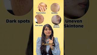 Skincare for Pigmentation and Uneven Skintone  Sunscreen for Pigmented skin  Dark Spots Melasma [upl. by Antonio146]