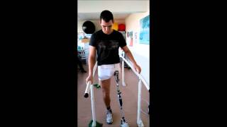 First time on prosthetic leg with hip disarticulation [upl. by Ysabel604]