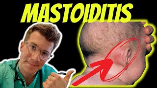 Doctor ODonovan explains Mastoiditis  including anatomy symptoms diagnosis and treatment [upl. by Haroppiz]