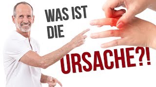 Darum hast du einen Schnappfinger – Ursachen verständlich erklärt ✅ [upl. by Anyah]