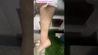 Thompsons test special test of lower leg Achilles tendon rupture special test diagnosisshorts [upl. by Yednarb234]