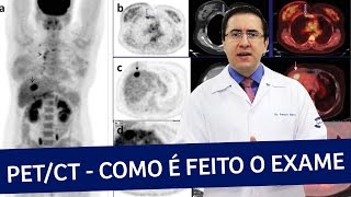 PET Scan ou PETCT  Como é feito o exame  IMEB [upl. by Euqnimod26]