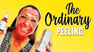 The Ordinary Peeling Resenha  Tratamento de Manchas [upl. by Drusilla]