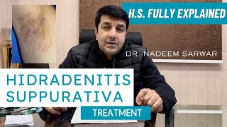 HS Hidradenitis Suppurativa Homeopathic Medicines and Treatment Explained  Dr Nadeem Sarwar [upl. by Ciapas]