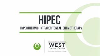 HIPEC Procedure  West Cancer Center [upl. by Nodanrb]