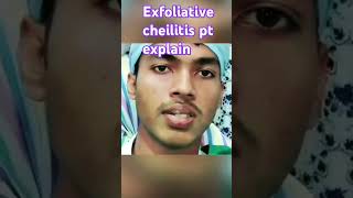 Exfoliative cheilitis explain by patient [upl. by Lancey]