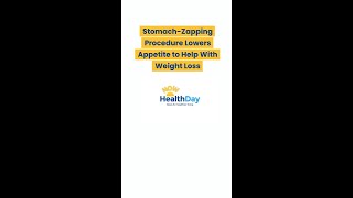 StomachZapping Procedure Lowers Appetite to Help With Weight Loss [upl. by Notlrahc61]