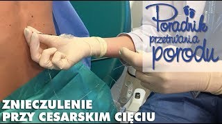 Wszystko co musisz wiedzieć o znieczuleniu do cesarskiego cięcia Poradnik Przetrwania Porodu [upl. by Ilat940]