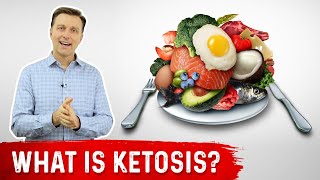 What is Ketosis  Dr Berg [upl. by Stier]