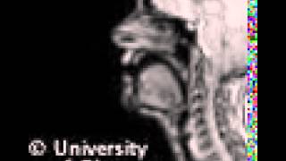 MRI voiced uvular implosive [upl. by Arakahs]