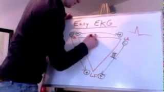 Easy EKG Einthovens Triangle [upl. by Arihas]