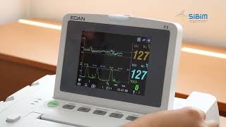 CAPACITACIÓN MONITOR FETAL GEMELAR F3 [upl. by Nethsa]