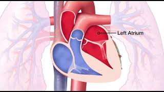 Mitral Valve Regurgitation [upl. by Muhcan590]