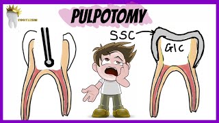 PEDIATRIC DENTISTRY  PULPOTOMY  Types Indications Procedure [upl. by Eachern]