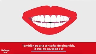 Encías sangrantes y los signos de la gingivitis  Colgate® [upl. by Annoda]