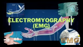 Electromyography  Electromyograph  Electromyogram  EMG  EMG Test  EMG Procedure [upl. by Adnohral]