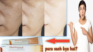 Bellissa lite cream review  benefits side effects  in hindi  Jaaniye pura sach [upl. by Nanaek]