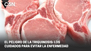 Los CUIDADOS para EVITAR la TRIQUINOSIS [upl. by Terrijo]