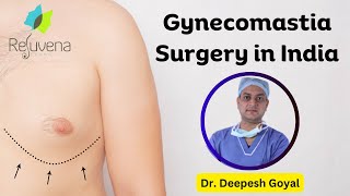 Gynecomastia Surgery in India Cost Procedure amp Results  Dr Deepesh Goyal Rejuvena Cosmo Care [upl. by Ardnaeed]