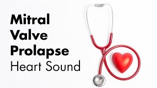 Mitral Valve Prolapse  Heart Sounds  MEDZCOOL [upl. by Mandel990]