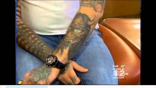 Solution or PicoSure Laser Tattoo Removal  Pittsburgh Pa [upl. by Fromma]