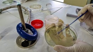 El laboratorio de Microbiologia y el urocultivo [upl. by Ecitsuj]