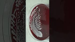 Growth Character of Staphylococcus hominis on Blood Agar Colony Morphology and Diagnostic Insights [upl. by Amelita]