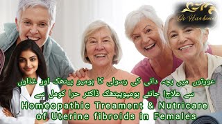 uterine fibroids treatment [upl. by Carilla]