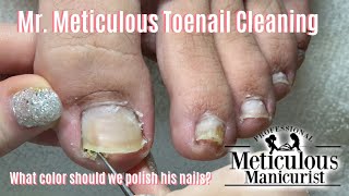 Shortn Sweet  Mr Meticulous Satisfying Impacted Toenail Cleaning [upl. by Trub]