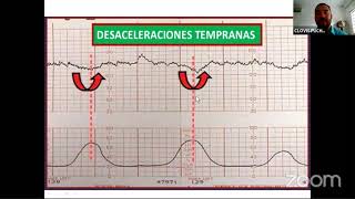 Evaluación del bienestar fetal [upl. by Yot]