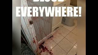 BLOOD EVERYWHERE Man dies a brutal death  Boston trauma amp crime scene cleanup company responds [upl. by Nerfe]