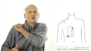 Chest Pain 3 Referred pain [upl. by Wilhide]