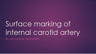 Internal Carorid Artery MNEMONICS  Easy to remember [upl. by Esoj]